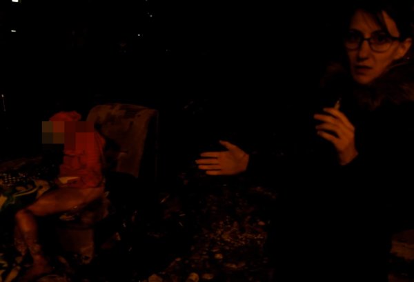 Женщину с гангреной оставили умирать у входа сочинской больницы